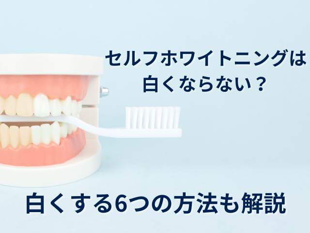 セルフホワイトニングは白くならない？セルフでできる歯を白くする6 