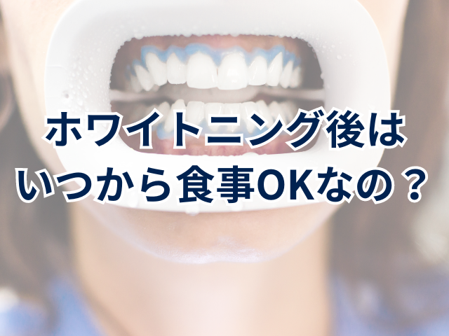 ホワイトニング後はいつから食事OKなの？